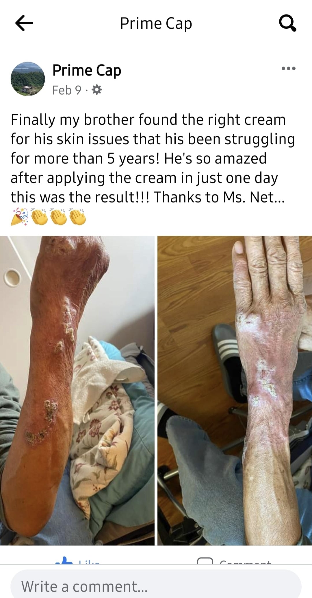 Skin soothing- Healing cream