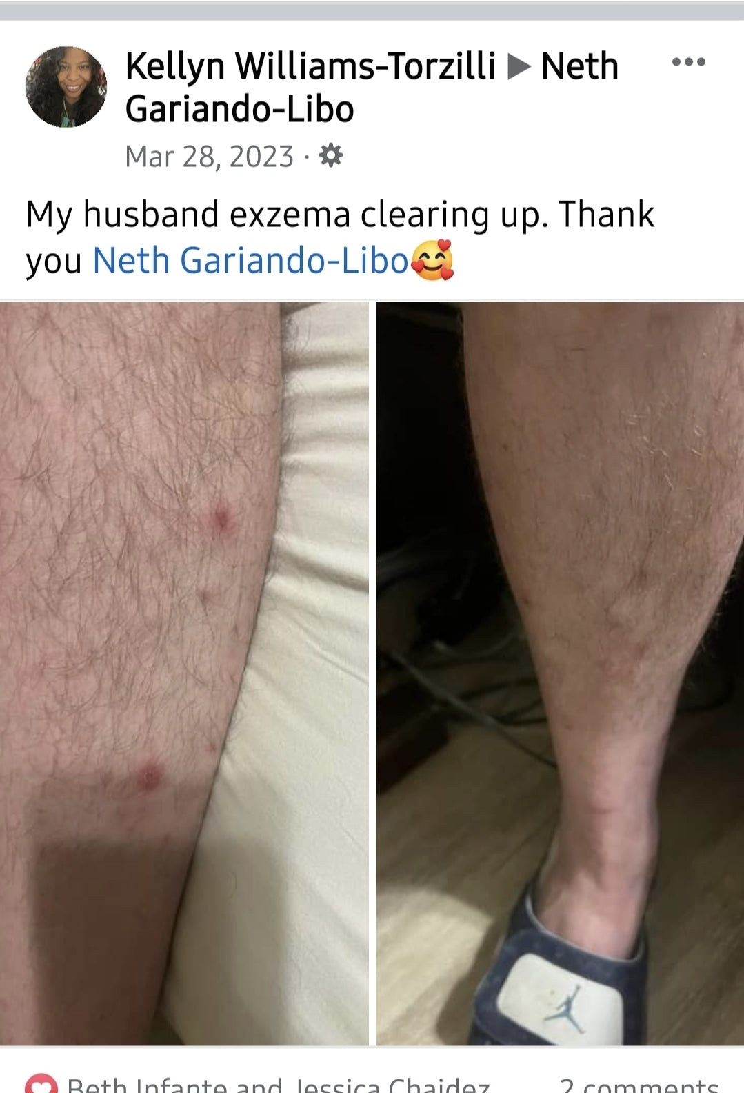 Skin soothing- Healing cream