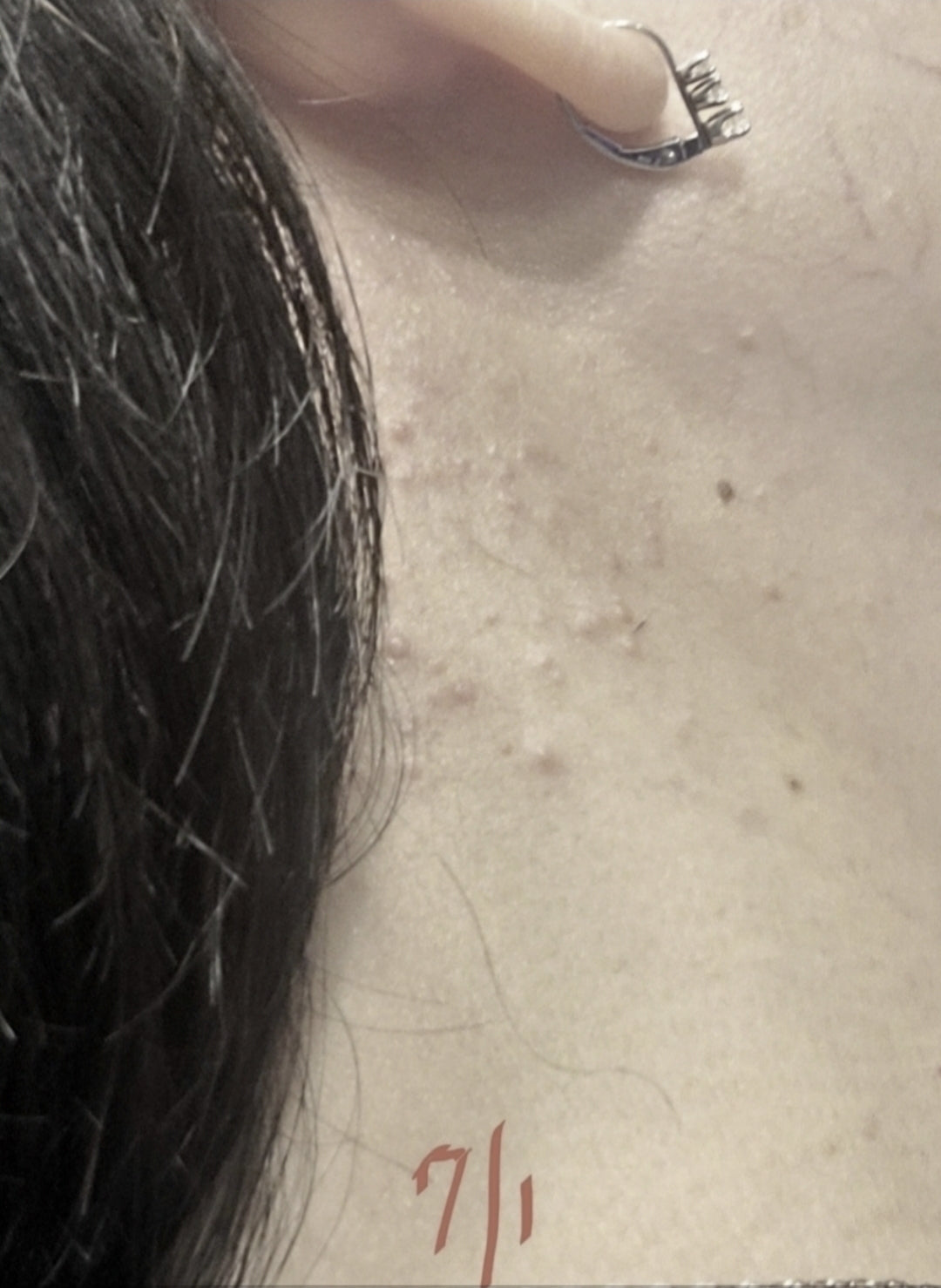 Skin soothing- Healing cream