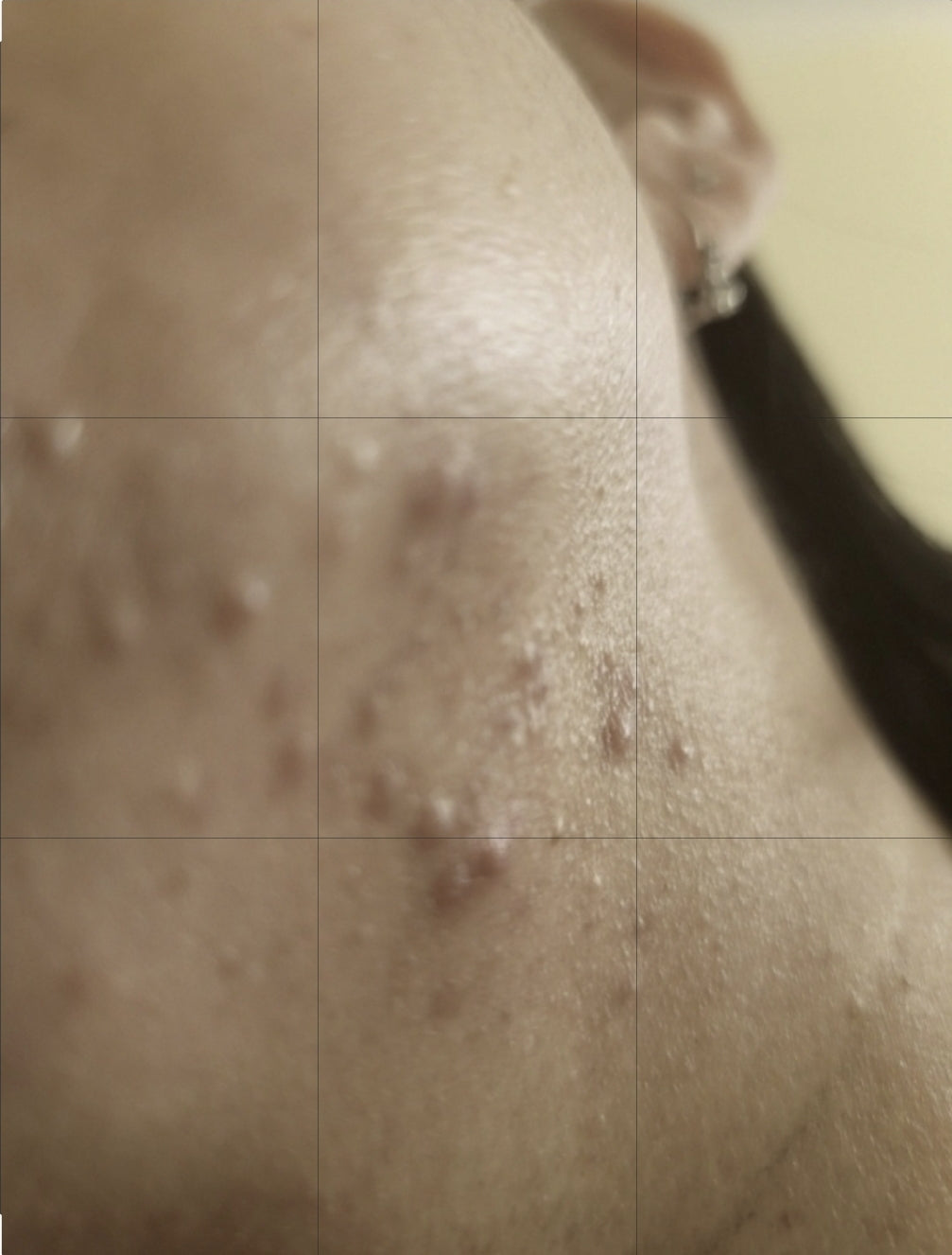 Skin soothing- Healing cream