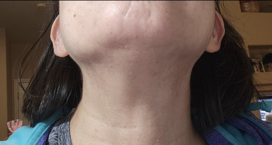 Skin soothing- Healing cream